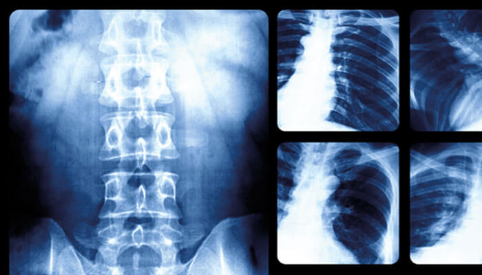 radiograf&iacute;a generada por espectro electromagn&eacute;tico