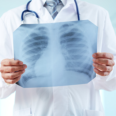 rayos X fue otro de sus descubrimientos m&aacute;s destacados.